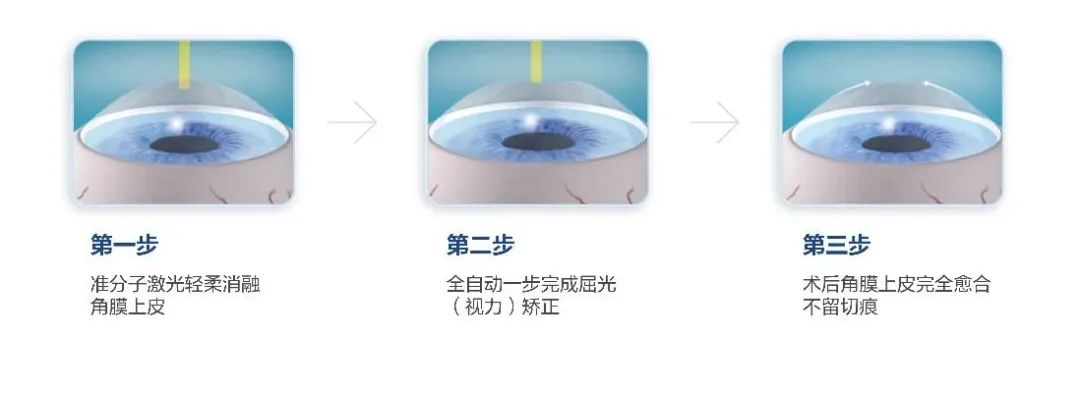2025年海軍招飛新變化！鄭州愛爾眼科醫(yī)院游昌濤：做完近視手術(shù)也能參加選拔(圖3)